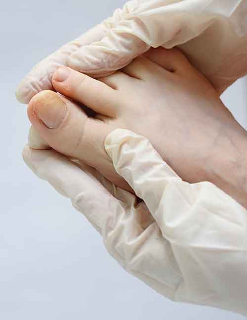 Podiatrist inspecting toes